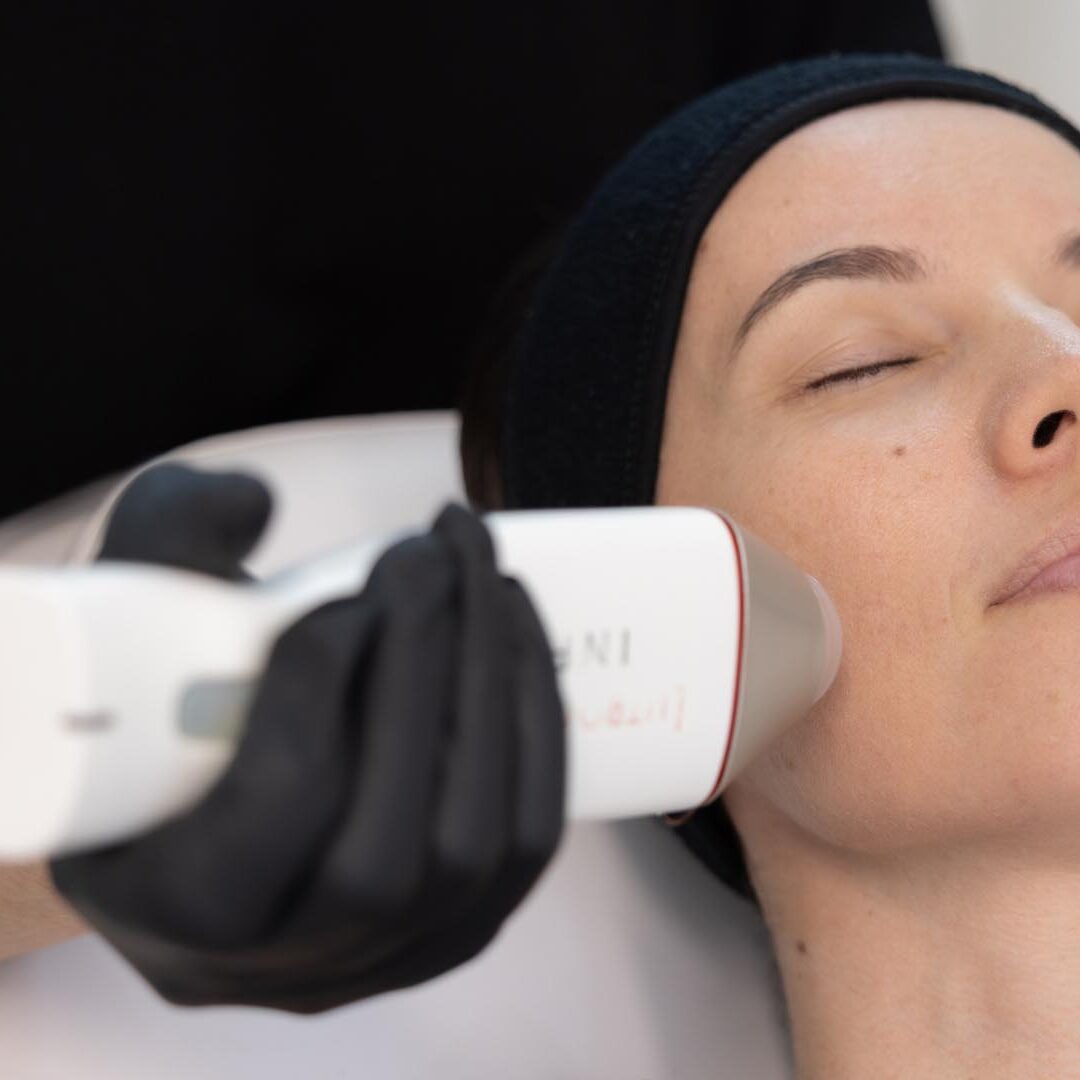 ageless-cosmetic-bar-cairns-8